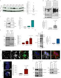 lsm nudes 020|Shaved Sexy Brunette Babe with Pierced Nipples Wearing Socks - TGP gallery  #182515