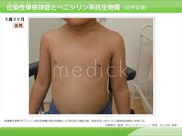女児症例|症例ナンバー０４１ 8歳女児 | 診療紹介