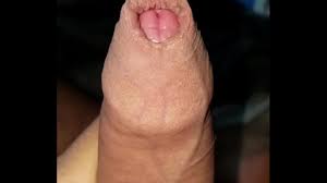 Big head dick jpg x Head dick