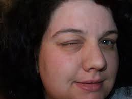 images?q=tbn:ANd9GcSo32BEAMW-AOm7m4KFYkR3IhQzmxR8d35AyrghoHFe6IF2C-TdNw