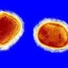 「サル痘」の感染報告、欧米などで相次ぐ 保健当局が調査 - BBC ...