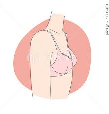 teen tit|Gynecomastia Surgery For Teens - Philadelphia Plastic Surgery by Cosmetic  Surgeon Adrian Lo M.D., FACS, FRCS(C)