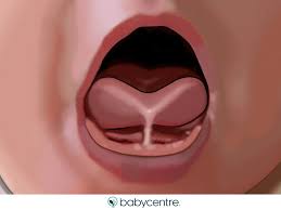 sperm on tongue|Squid Sperm Sacks Found in Woman's Gums? - YouTube