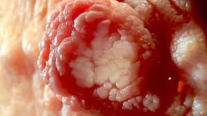 Extreme closeup jpg x Extreme close