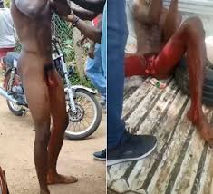 Man who had penis cut off wife went jpg x Dick cut off