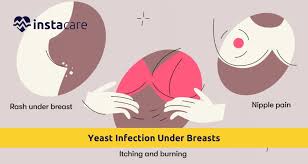 Search yeast infection from sex page jpg x Yeast infection