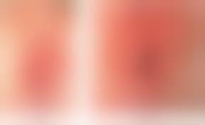 prepubertAL VAGINA|Prepubertal Genital Bleeding: Examination and Differential Diagnosis in  Pediatric Female Patients