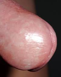 My tiny dick and bih head dick jpg x Head dick