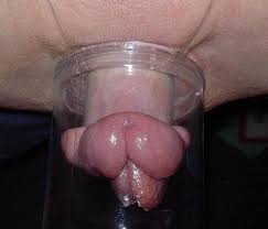Guy uses vacuum pump to make girl pussy lips bigger before fuck porn tube jpg x Pussy suction