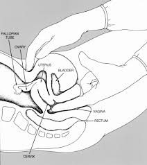 child examination vagina|🌸 Vaginal Examination 🌸 In midwifery care, a Vaginal Examination (VE) can  used to assess the degree of opening of the cervix so that the labour  progress and time of birth can