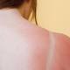 Don't let summer fun lead to skin cancer 