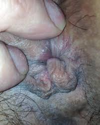 Asshole close jpg x Asshole close up