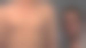 tiny puff nipples|Case Study: Reduction of Puffy Nipples in Young Men - Explore Plastic  Surgery