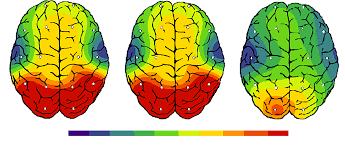 krystal orcid teen nude|World Journal of Psychiatry