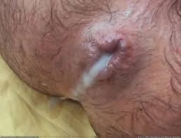 First anal fist teen ruined asshole anal gape loose assholee jpg x Destroyed ass anal