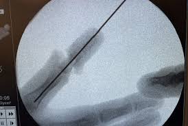 young nude boys ru vk|Boy loses part of finger in accident – St Petersburg University Clinic  operates | St Petersburg University