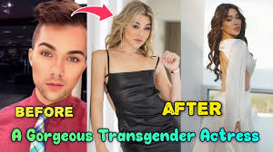 Cosmetic makeovers jpg x Before after
