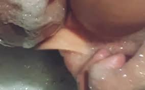 Candida infection of the penis jpg x Yeast infection