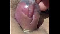 Clit suction toy porn videos jpg x Pussy suction