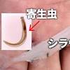 《皮膚の下をモゾモゾ》顎口虫症が青森県で初確認。