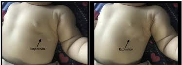 女児症例|症例ナンバー045 8歳女児 | 診療紹介