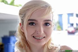 Teen braces porno and best sex videos jpg x Teens with braces getting