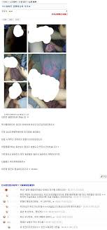 소라넷골뱅이 |골뱅이