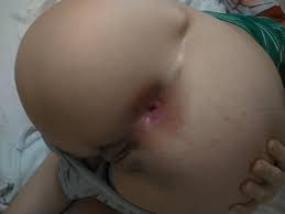 Reddit amateur anal jpg x Reddit amateur anal