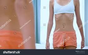 anorexic teens|Anorexia in Teenagers | Eating Disorder Treatment in ID