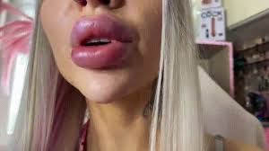 Busty bimbo with huge fake lips jpg x Big fake lips