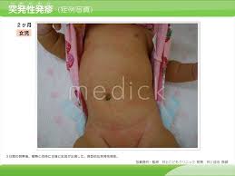 女児症例|症例ナンバー０３１ １０歳女児 | 診療紹介