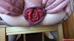 Anal prolapse fuck gay porn popular videos gay bingo jpg x Prolapse fuck