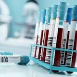 choosing the right treatment with a blood test