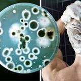 A bacteria found in showerheads can cause 'potentially fatal' pneumonia - are you at risk?