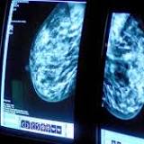 Queen's researchers receive grant from Breast Cancer Now to search for new treatments