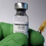 Tuberculosis Vaccine Market Growth in Future Scope 2022-2028 | GlaxoSmithKline, Sanofi Pasture, Longcom ...