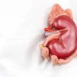 Chronic Kidney Disease (CKD) Drug Market Size, Demand , Trends, Growth, Share, Regional Analysis and Forecast ...