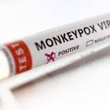 Whattha, Health Department Update On Possible Monkey Pox In New York City