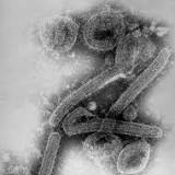 What Is Marburg Virus, the Deadly Disease in Ghana?