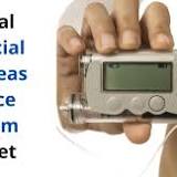 Artificial Pancreas Device System Market Growth, Size, Analysis, Outlook by Trends, Opportunities and Forecast to 2030