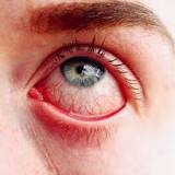 Eye-bleeding virus which kills 30 per cent of people infected spreads to Spain