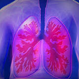 Study links area-level income and education with lung cancer diagnosis