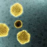 Mysterious hepatitis cases show up in Louisiana kids. CDC investigating 100  nationwide.