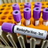 France monkeypox count rises to 277, one woman infected