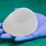 The FDA Says They Have Received Reports Of Various Cancers Occurring In The Scar Tissue Around Breast Implants