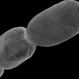 Scientists discovered the world's largest bacterium and you can see it with your naked eye