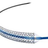 Surgical Stents Market Research Report 2022 Growth Share, Trends, Opportunities, Outlook & Forecast 2030