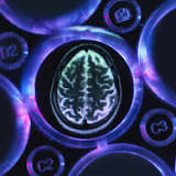 Manchester Scientists make major step towards Alzheimer's treatment