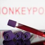 482 cas de variole du singe confirmés en Belgique, dont 28 hospitalisations