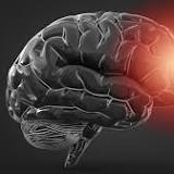 Covid-19 increases risk of neurodegenerative diseases: Study